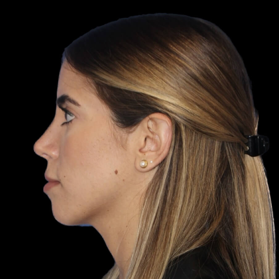 *Real Patients Shown After