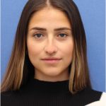 Primary Rhinoplasty Before & After Patient #742