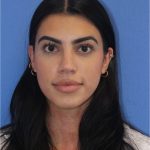 Revision Rhinoplasty Before & After Patient #876