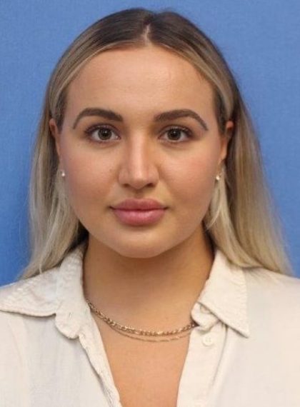 Primary Rhinoplasty Before & After Patient #778