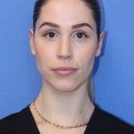 Primary Rhinoplasty Before & After Patient #743