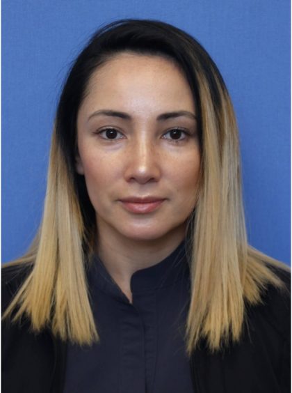 Primary Rhinoplasty Before & After Patient #775