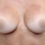 Breast Augmentation Before & After Patient #500