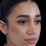 Primary Rhinoplasty Before & After Patient #1322