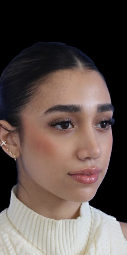 Primary Rhinoplasty Before & After Patient #1322
