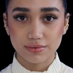 Primary Rhinoplasty Before & After Patient #1322