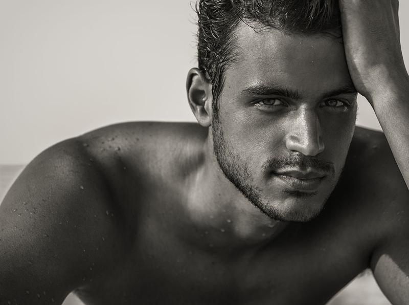 Male Rhinoplasty Dr. Marcelo Ghersi Aeris Plastic Surgery & Aesthetic Medicine