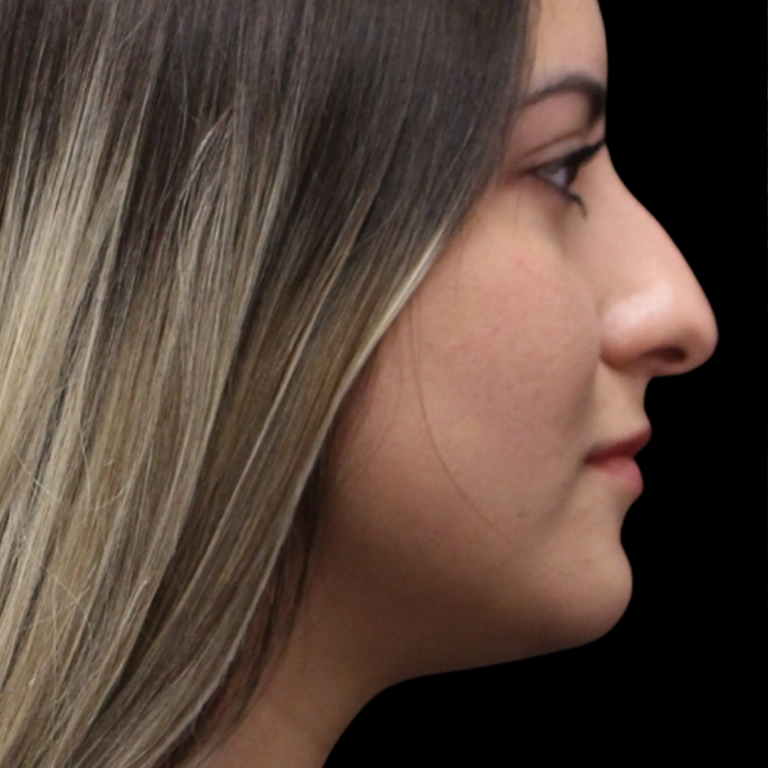 B&A