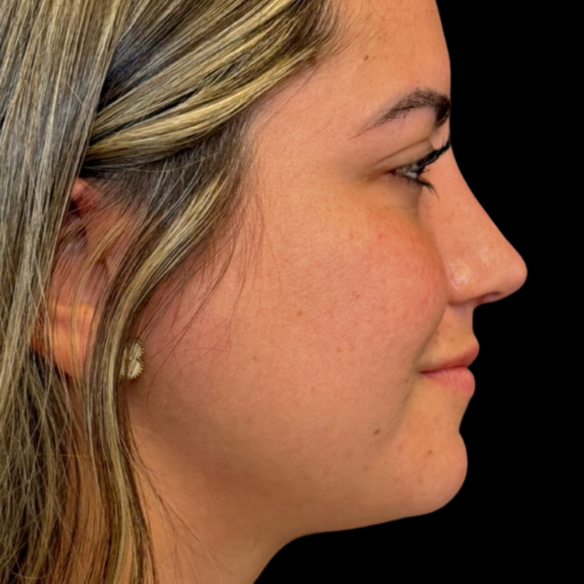 B&A
