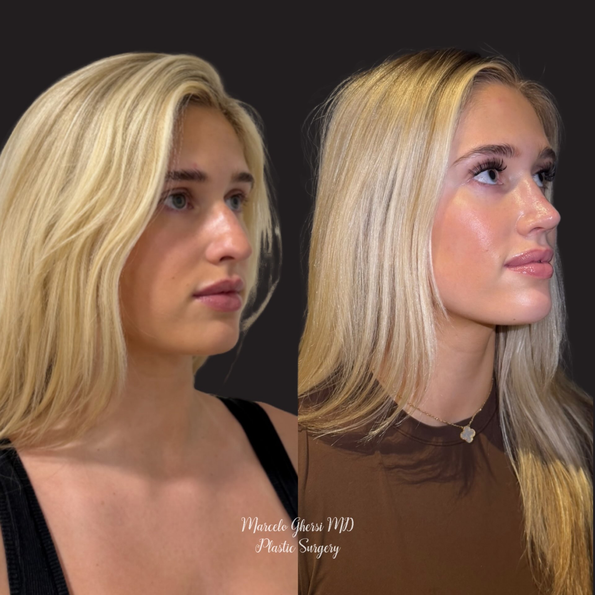 Before and After