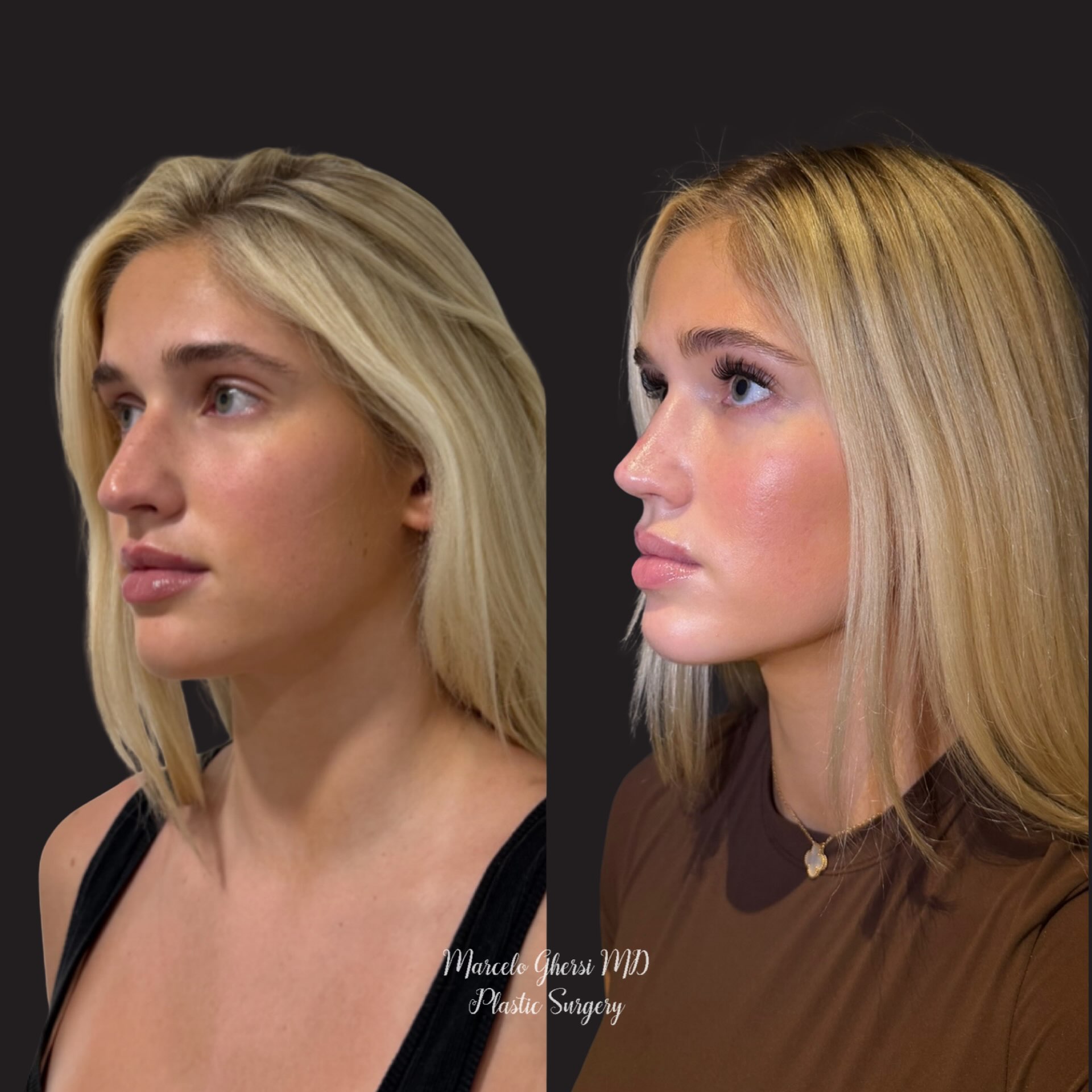 Before and After